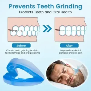 Anti-Snoring & Anti-Grinding Teeth Protector