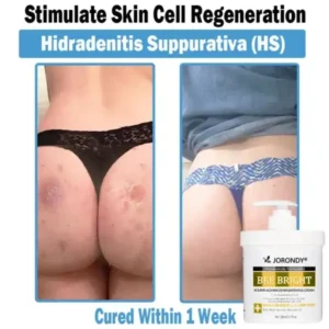 Bee Bright Multi-Symptom Skin Treatment Cream
