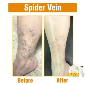 Bee Venom Comprehensive Cream