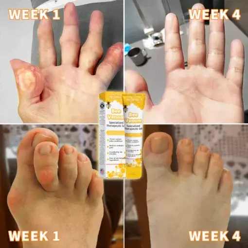 Bee Venom Joint Therapy Pain Relief Gel