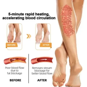 Bee Venom Lymphatic Drainage & Slimming Foot SoakBeads