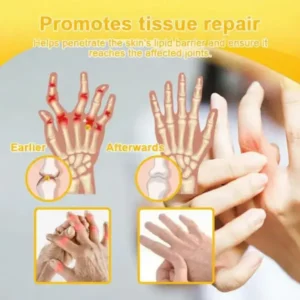 Bee Venom Pain-Relief Bone Healing Spray