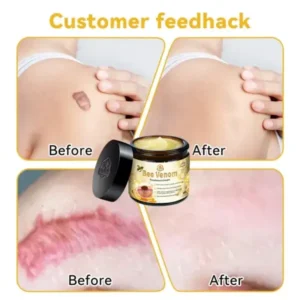 Bee Venom Skin Treatment Cream