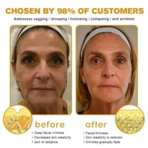 Botox Bee Venom Wrinkle Removal Cream
