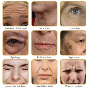 Botulin Bee Poison Wrinkle Removal Cream