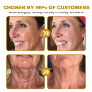 Botulin Bee Poison Wrinkle Removal Cream