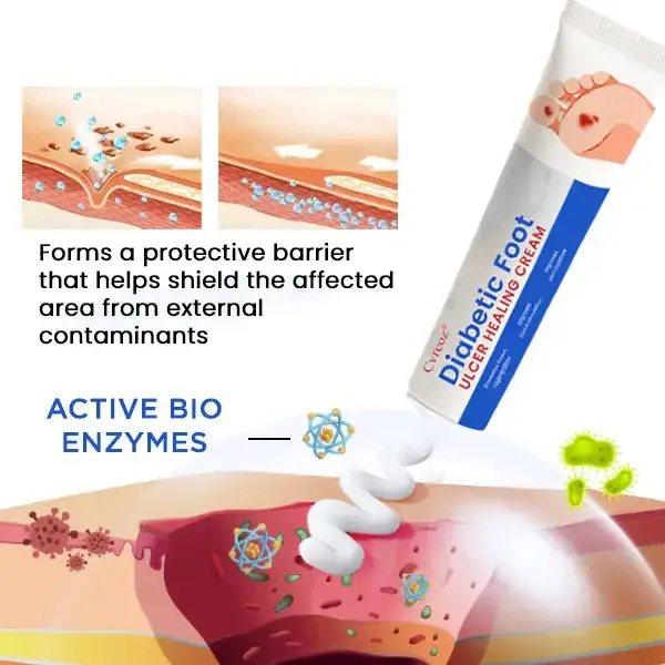 Diabetic Foot Ulcer Healing Cream