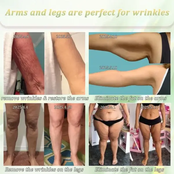 Firming Cream——Visibly Firms in Just 21 Days – Without Surgery or Irritation