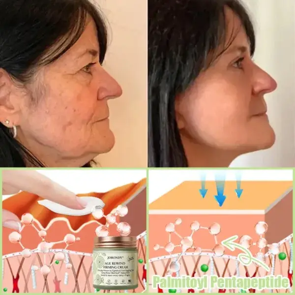 Firming Cream——Visibly Firms in Just 21 Days – Without Surgery or Irritation