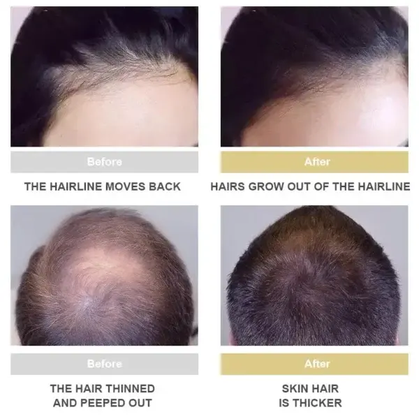 Hair Growth Essence