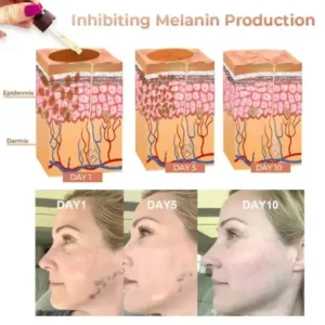 Melanin Correcting Facial Serum
