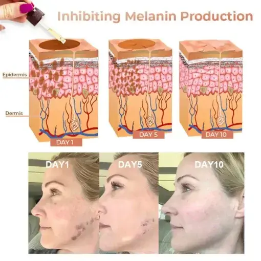 Melanin Correcting Facial Serum
