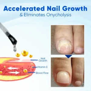 OnyxoGuard Nail Growth and Repair Serum