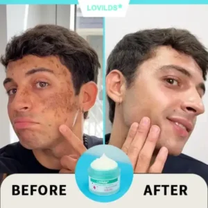 Renewal Skin Cream