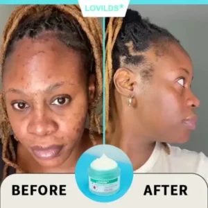 Renewal Skin Cream