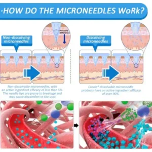 SMGT-GLP-1 Nano Microneedle Patch