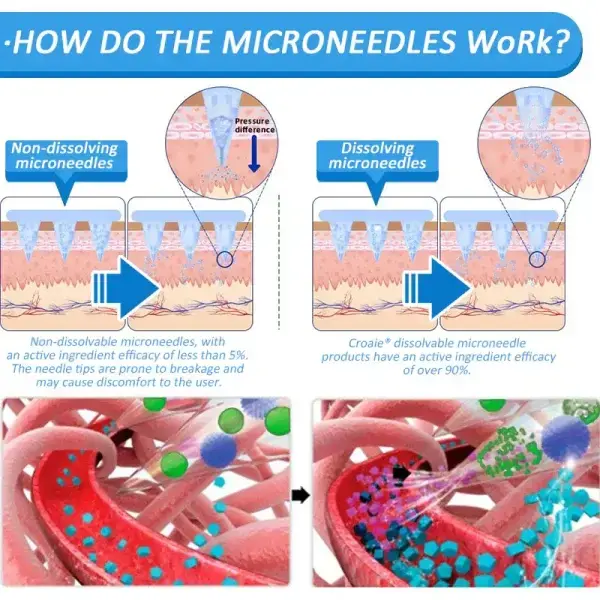 SMGT-GLP-1 Nano Microneedle Patch