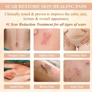 SiliconeFoam Healing Pads