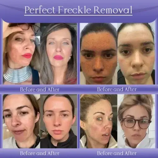 Skin Firming & Anti-Wrinkle Cream