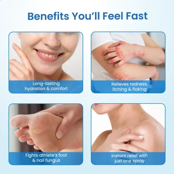 Timilk® MagnesiumHerb Psoriasis Relief Cream
