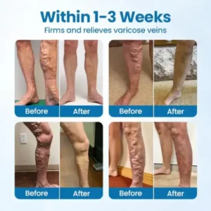 VeinGuard Herbal Spray