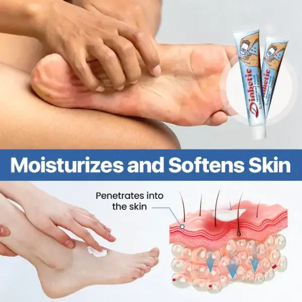 VitaGluco Diabetes Treatment Cream