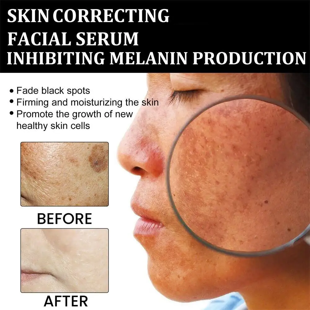 Fast Dark Spot Remover - Image 13
