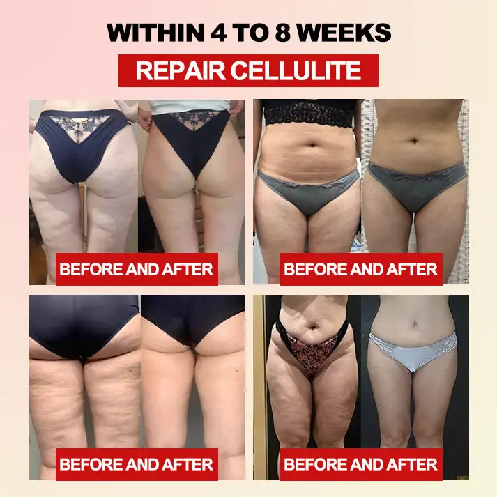 𝐅𝐢𝐛𝐞𝐫 𝐚𝐧𝐝 𝐖𝐨𝐫𝐦𝐰𝐨𝐨𝐝 𝐁𝐨𝐝𝐲 𝐒𝐡𝐚𝐩𝐢𝐧𝐠 𝐖𝐚𝐢𝐬𝐭 𝐏𝐫𝐨𝐭𝐞𝐜𝐭𝐨𝐫 - Image 6