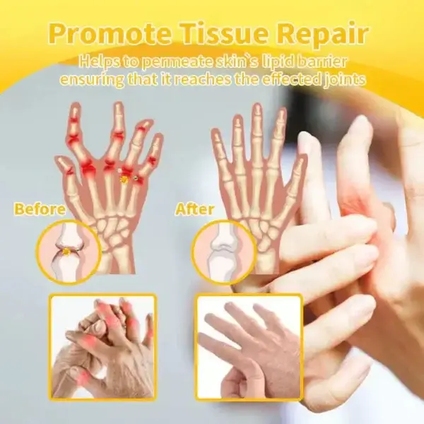 Magnesium Oil & Bee Venom Joint Healing Spray Approved by the American Academy of Orthopaedic Surgeons (AAOS) - Image 7