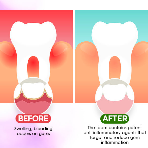 Gum Treatment Foam - Image 4