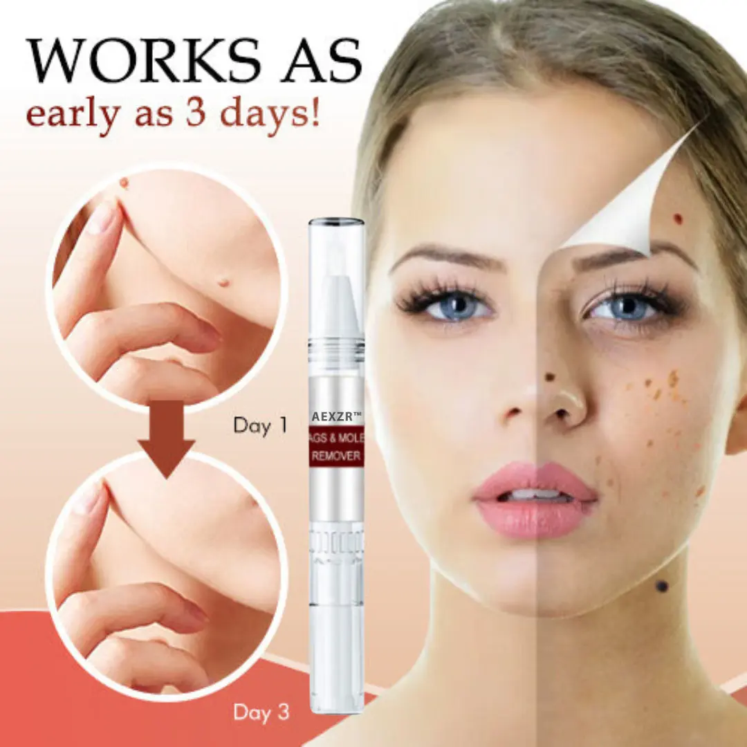 Tags & Moles Remover - Image 4