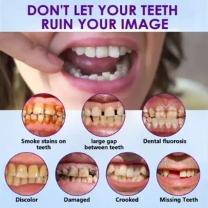 Advanced Customized Full Denture Set