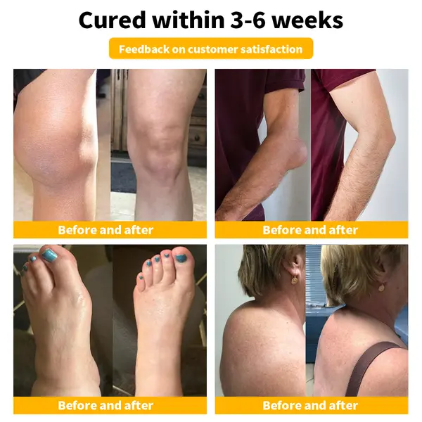 Bee Venom & Turmeric Arthritis Therapy Cream - Image 3