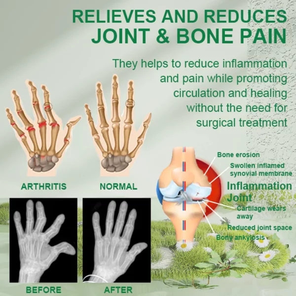 Bee Venom Joint & Bone Therapy Cream - Image 2