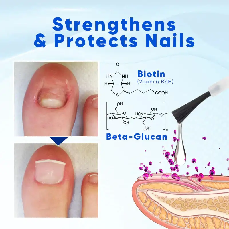 From Damaged & Peeling to Strong & Beautiful - Image 2