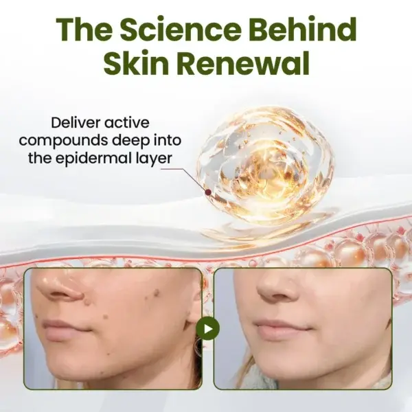 MagneErase Renewal Cream - Image 4