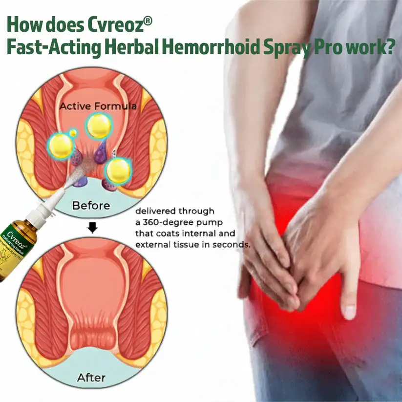 Fast-Acting Herbal Hemorrhoid Spray Pro - Image 3