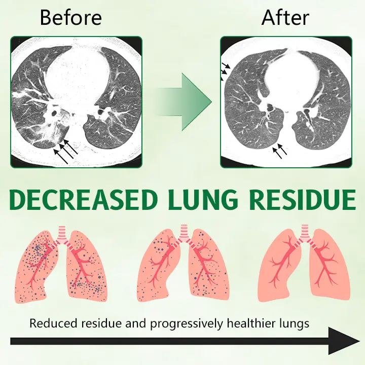 Herbal Antibacterial Lung Cleansing Nasal Spray - Image 4