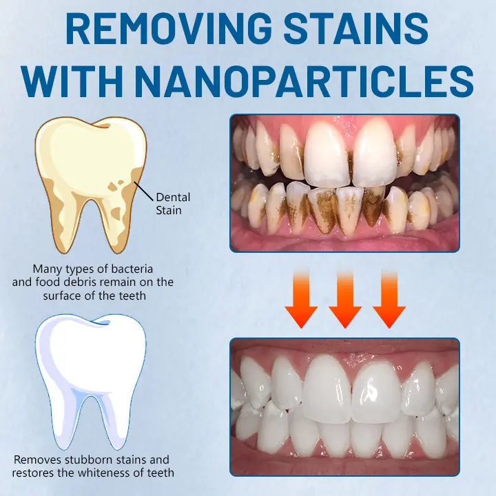 Highly effective tooth stain cleaner - Image 2