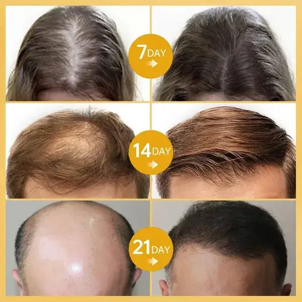 Rosemary Hair Growth Essence - Image 6