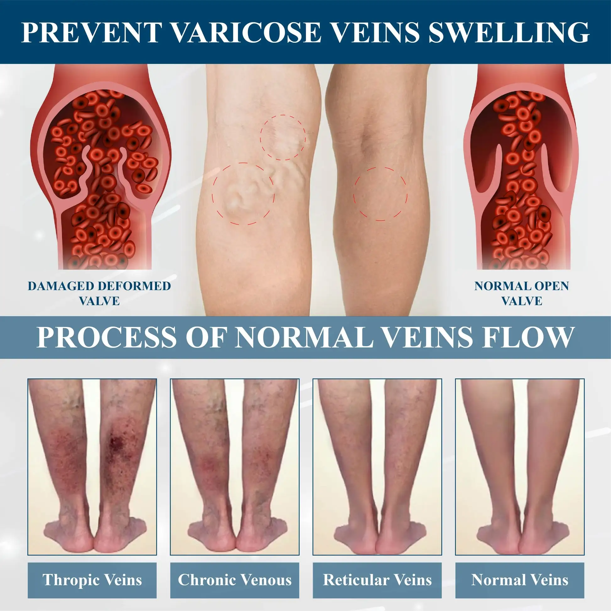 Magnetic EdemaCare Insoles - Image 8
