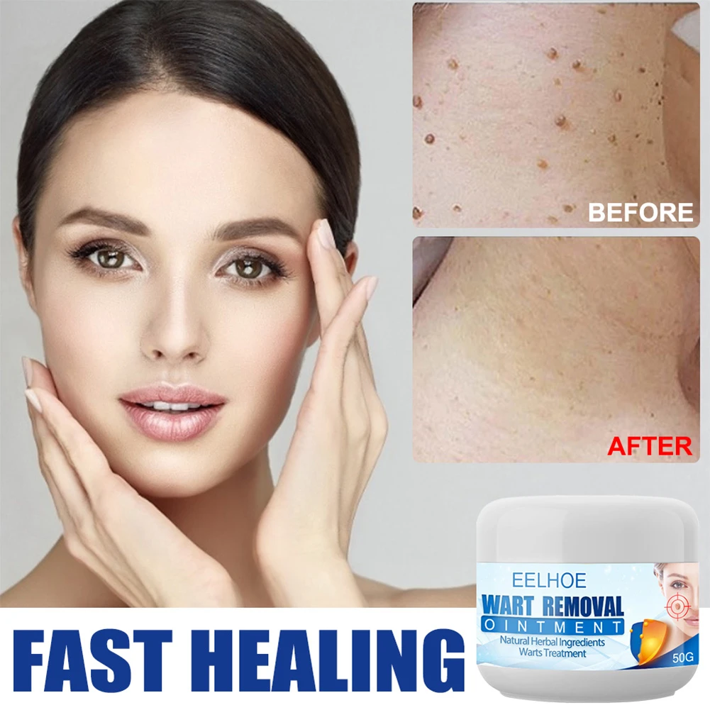 PRO Petechiae Removal Cream - Image 2