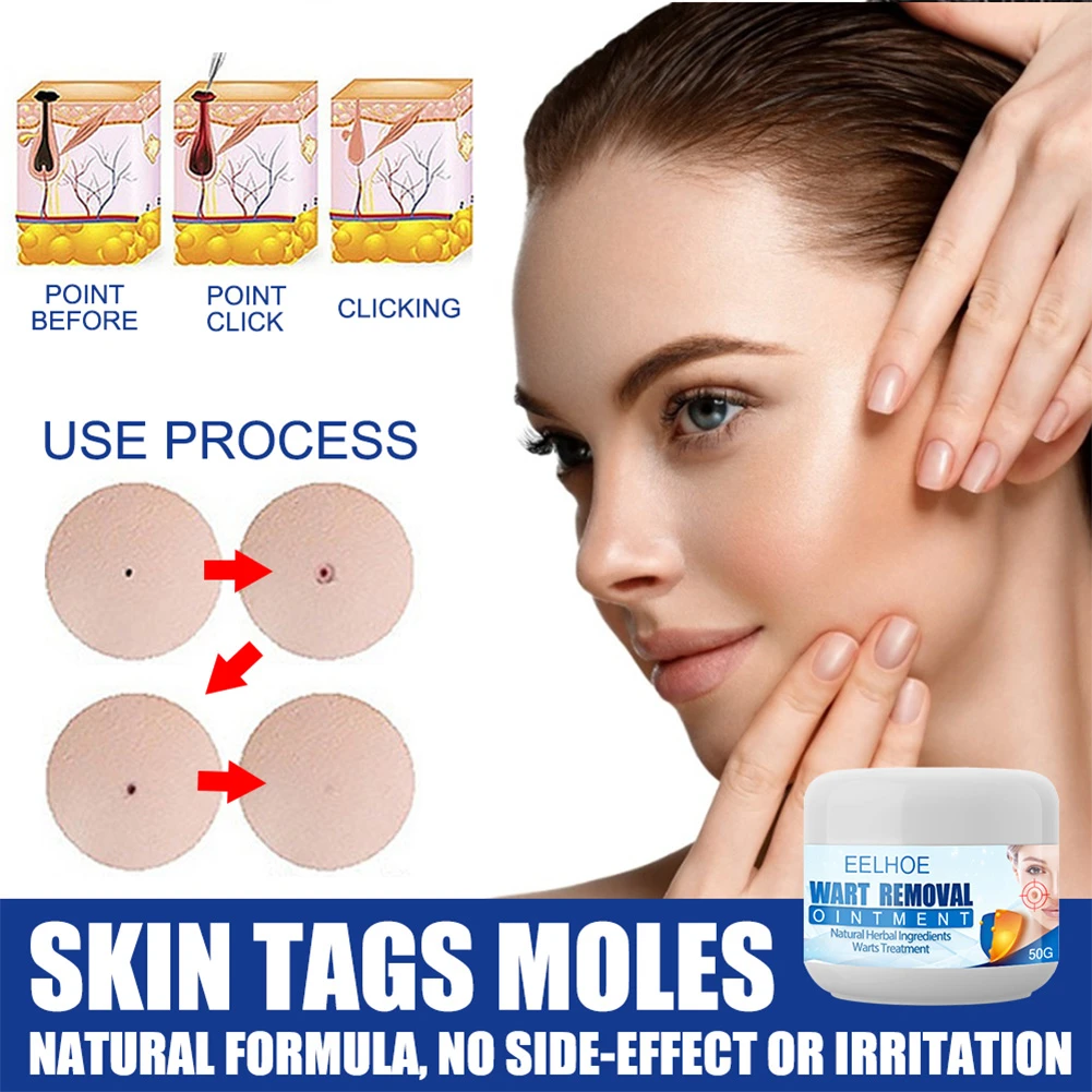 PRO Petechiae Removal Cream - Image 4