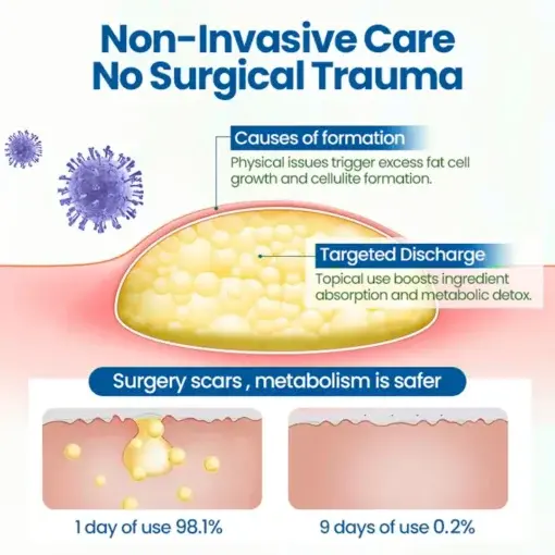 BumpClear Lipoma Removal Cream - Image 7