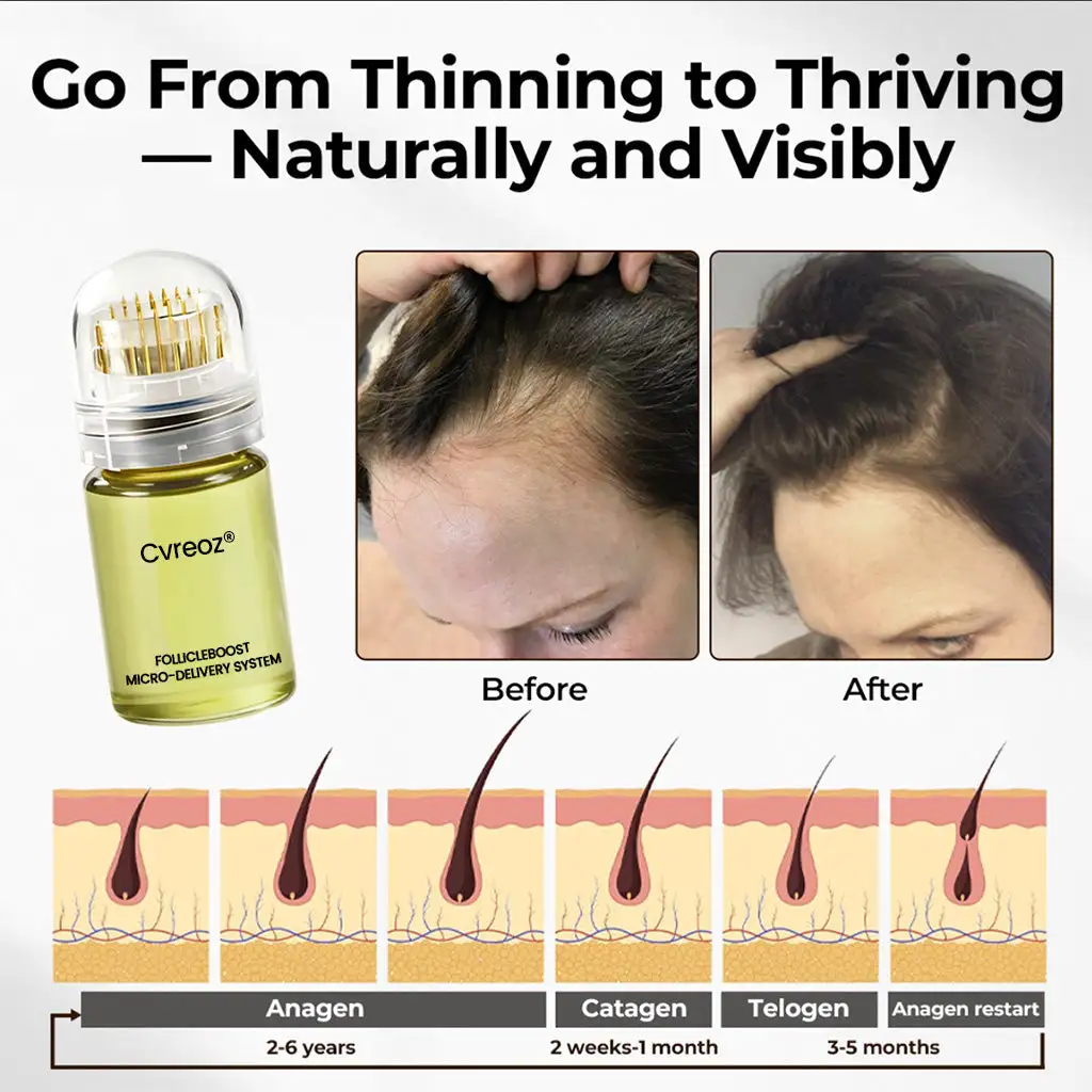 FollicleBoost Micro-Delivery System Advanced Scalp Renewal Kit - Image 4