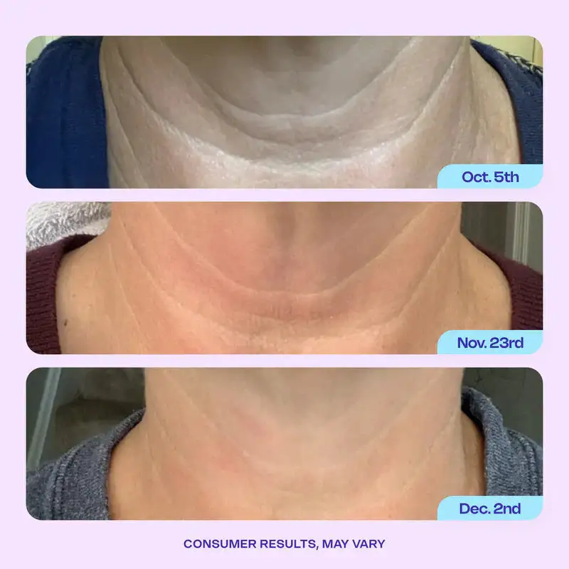 DIYSTAR Neck Cream Tighten & Lift Firming Cream - Image 2