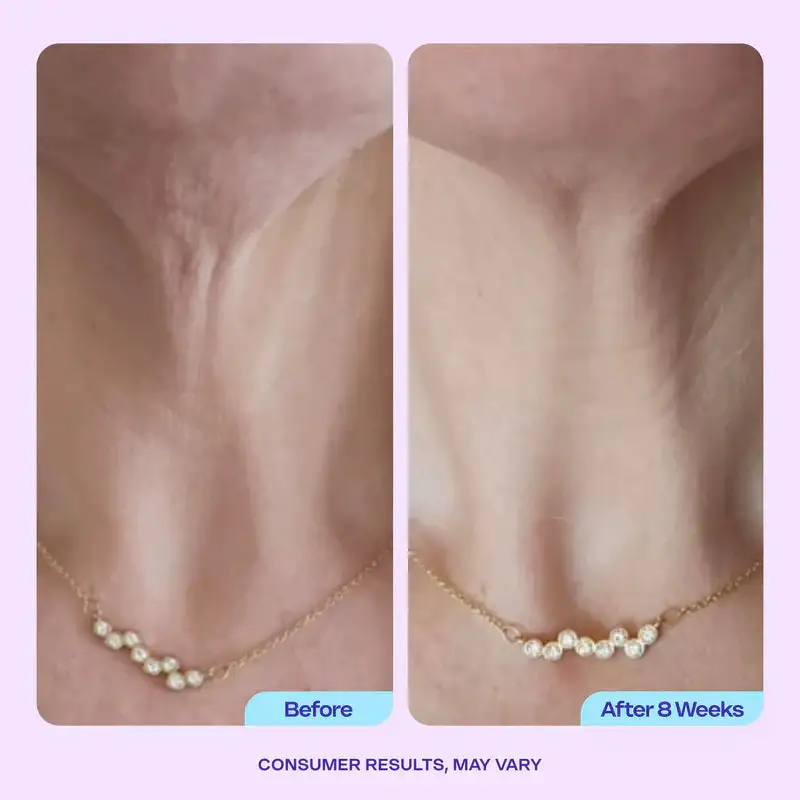 DIYSTAR Neck Cream Tighten & Lift Firming Cream - Image 5