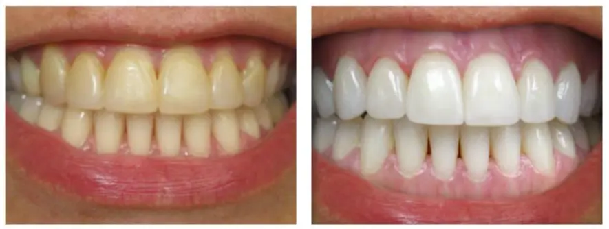 Niacinamide Intensive Whitening Toothpaste - Image 7