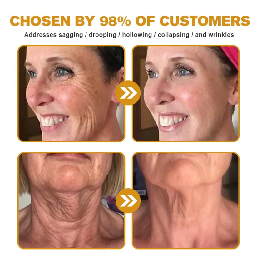 Bee Venom Skin Restoration Cream - Image 3