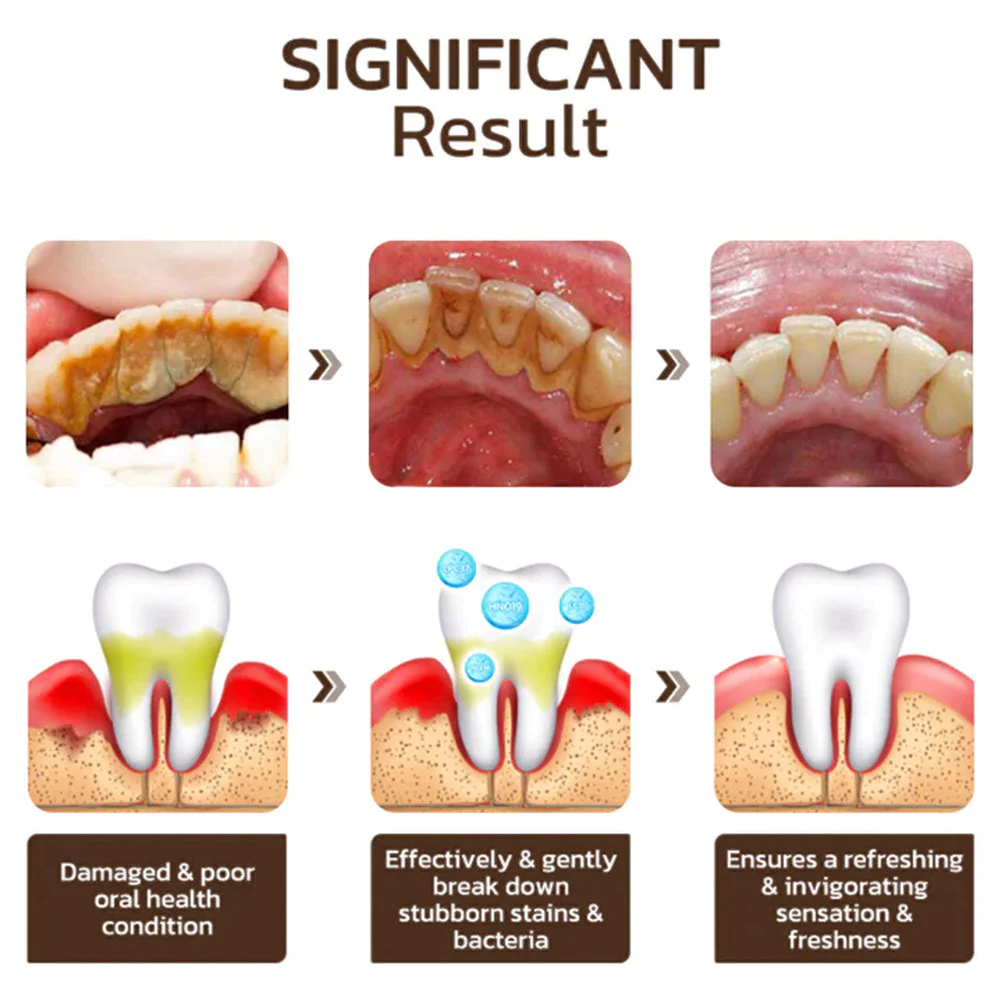 Niacinamide Whitening Toothpaste - Image 5